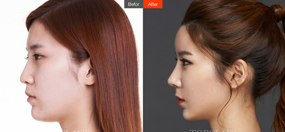 http://baidu.91hmzx.com/zt/noses/images/img_07.jpg